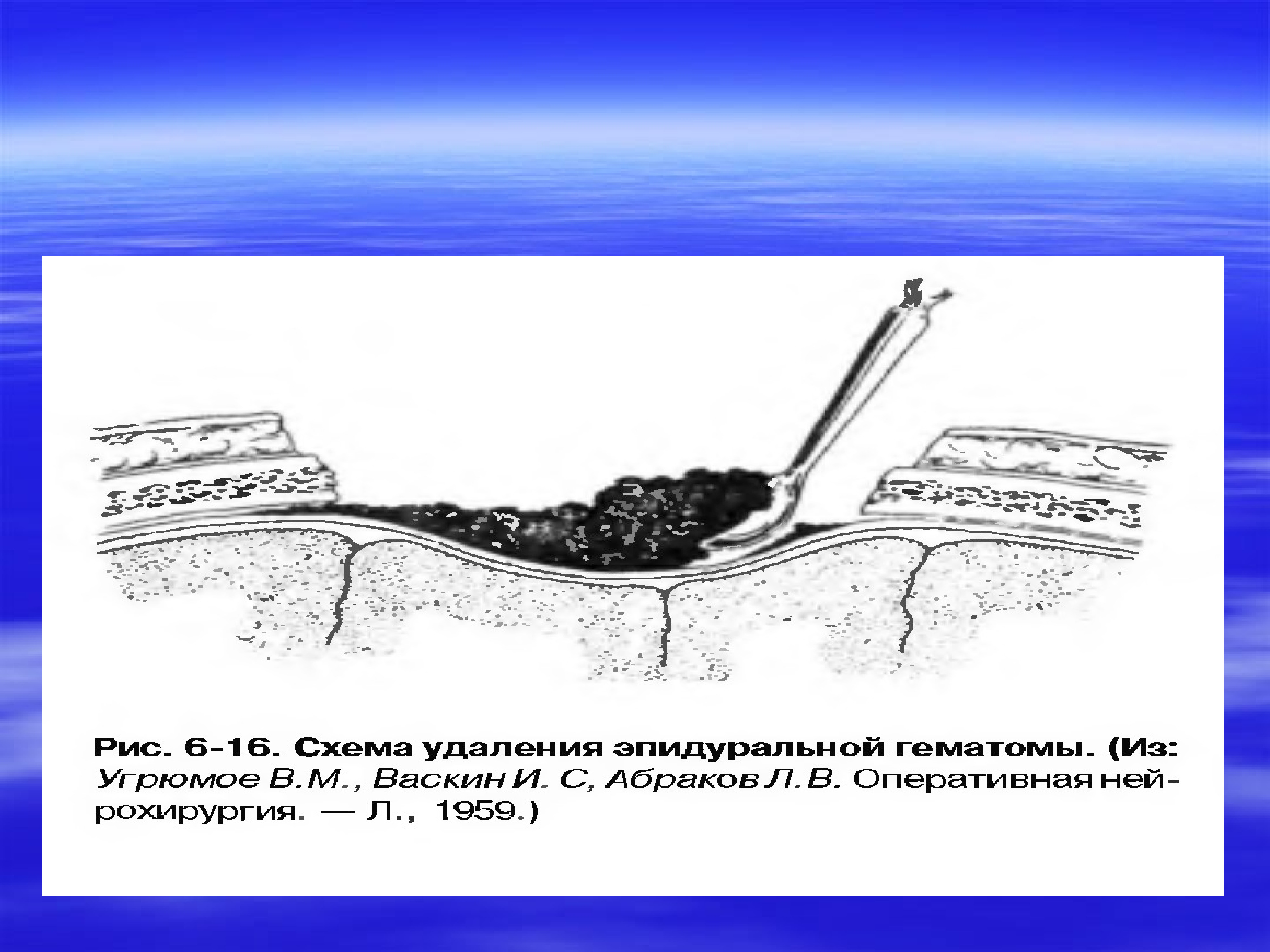 Презентация операции на голове