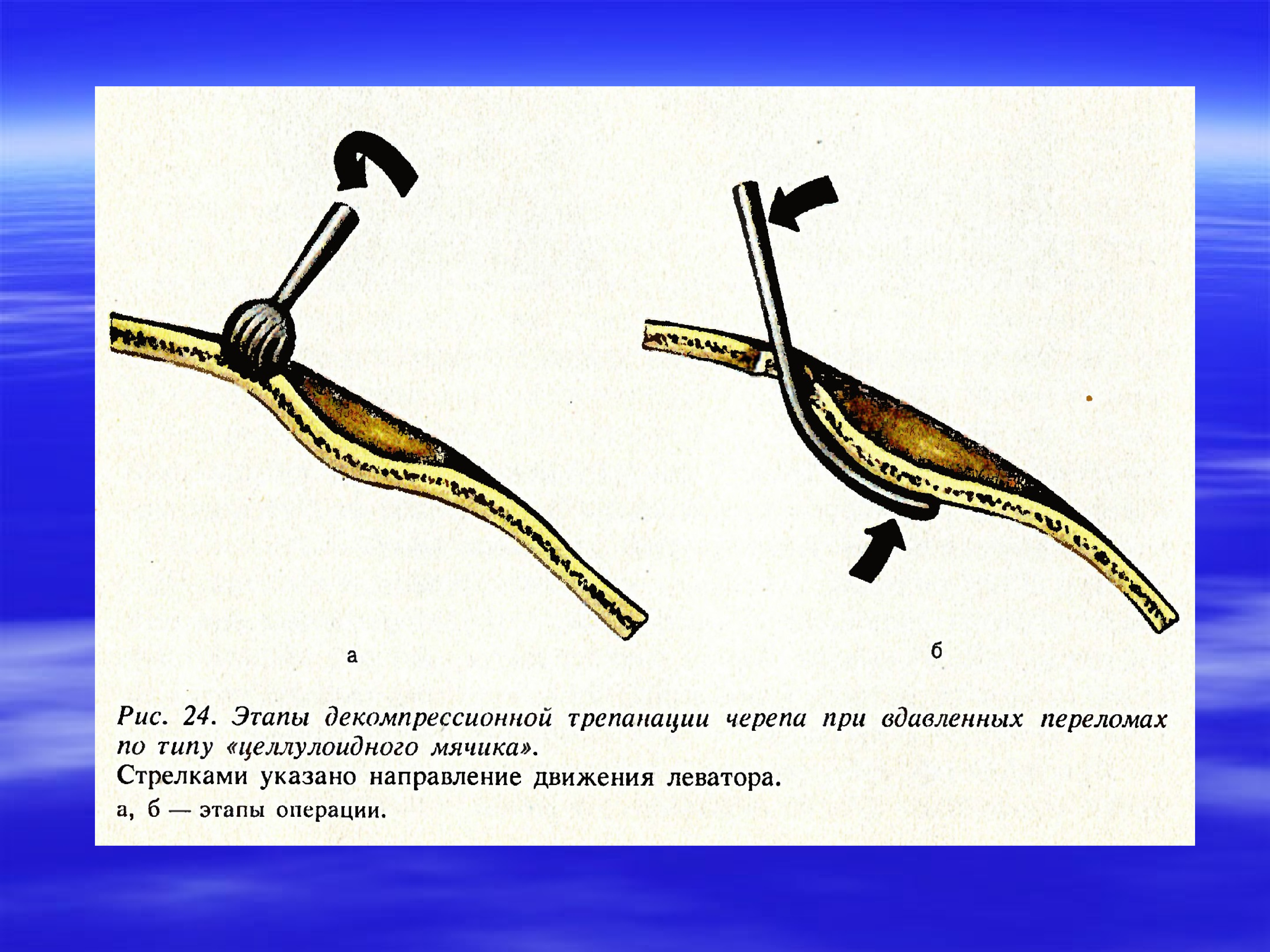 Презентация операции на голове