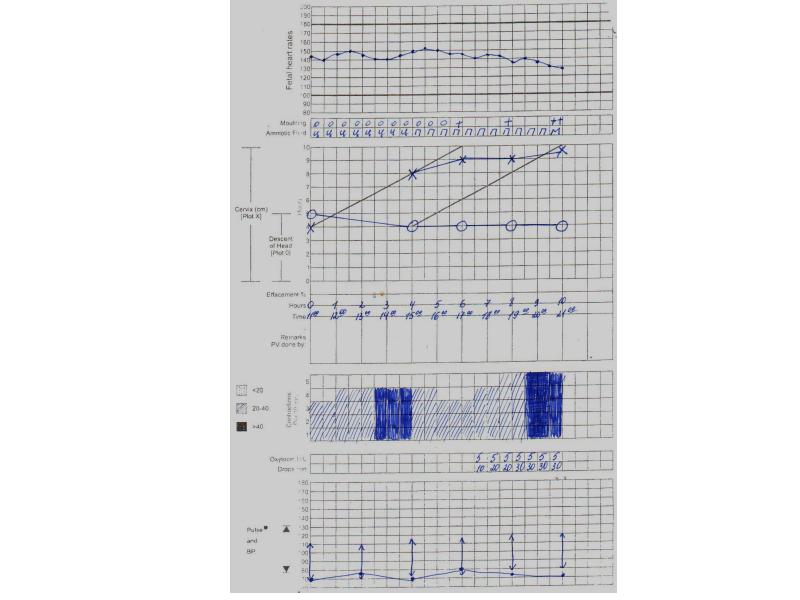 Партограмма как заполнять образец