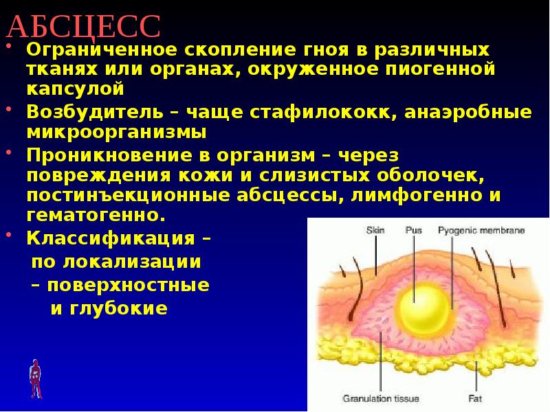 Гнойные заболевания легких презентация