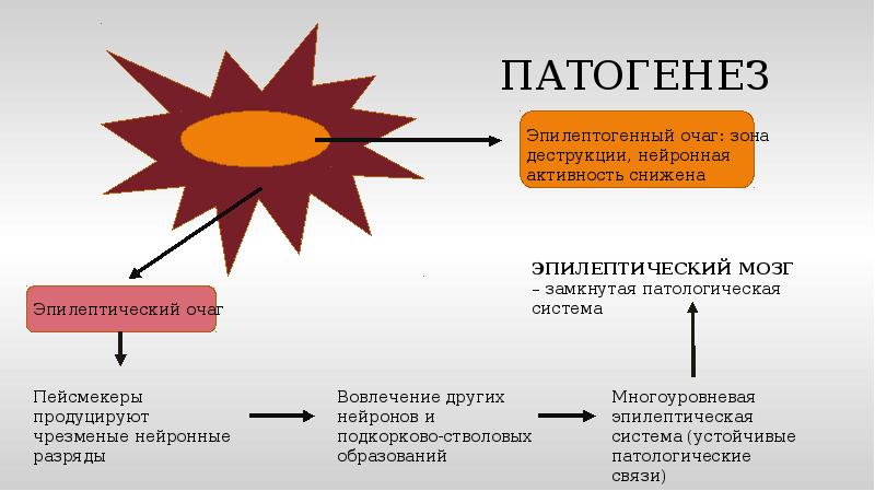 Патогенез эпилепсии схема