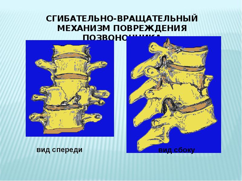 Повреждения позвоночника и таза презентация