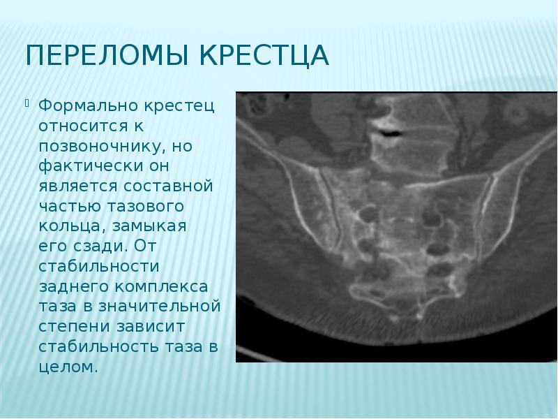 Повреждения позвоночника и таза презентация