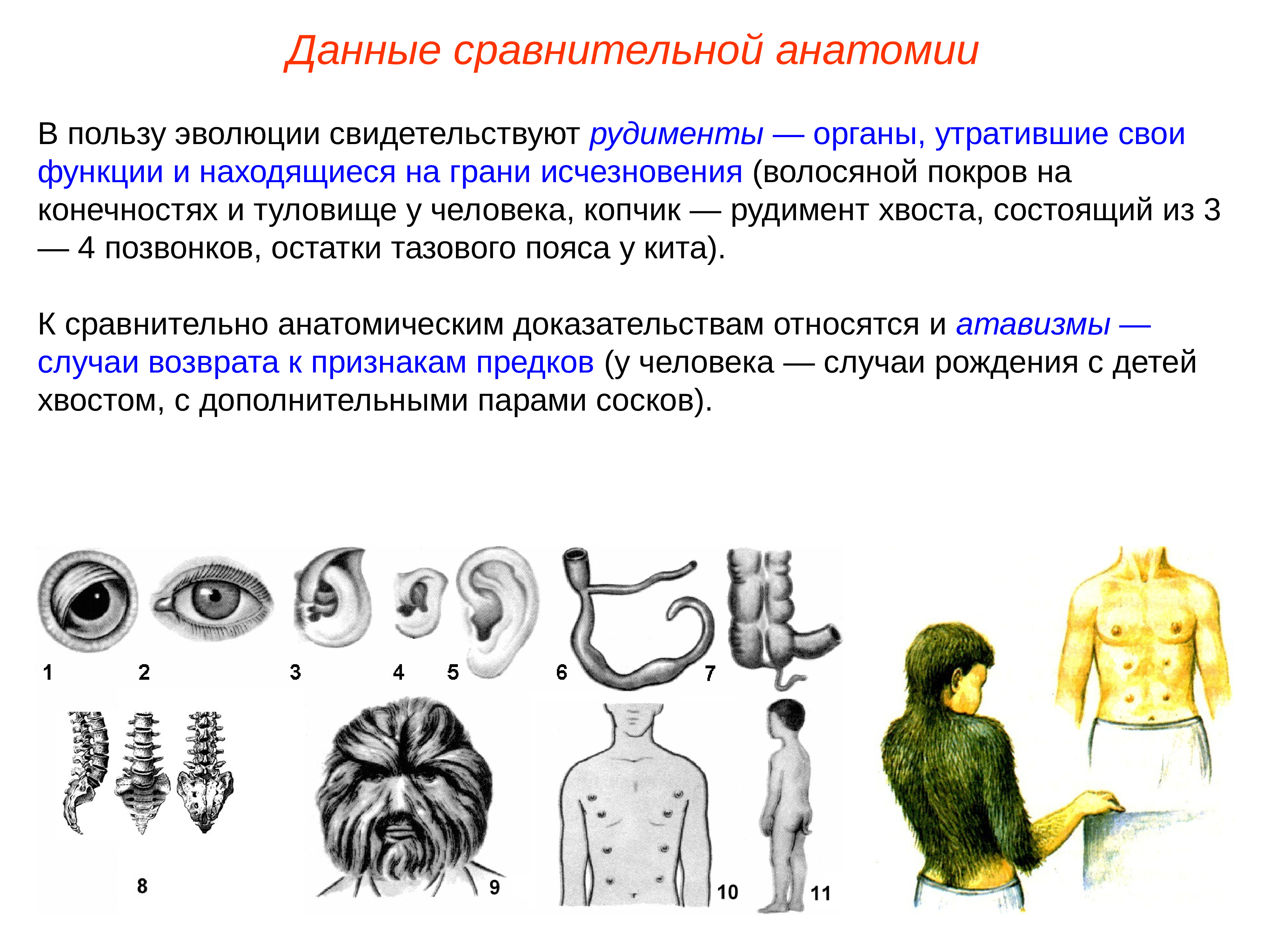 Рудимент доказательство эволюции. Атавизмы доказательства эволюции. Сравнительно-анатомические доказательства рудименты. Сравнительно-анатомические доказательства эволюции атавизмы. Данные сравнительной анатомии.