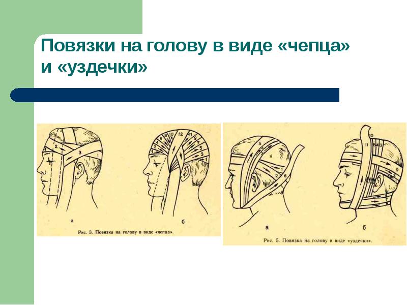 Виды повязок и способы их наложения с картинками для школьников