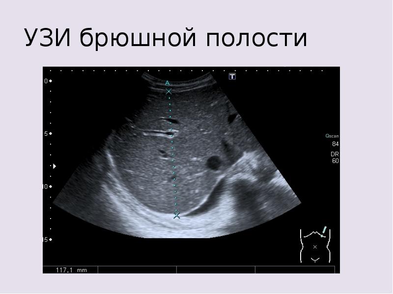 Презентация на тему узи брюшной полости