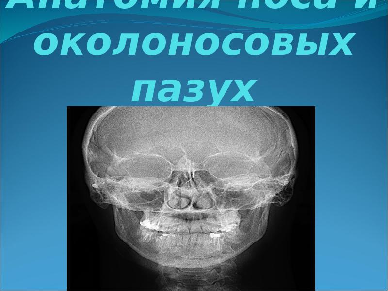 Презентация носа и околоносовых пазух презентация