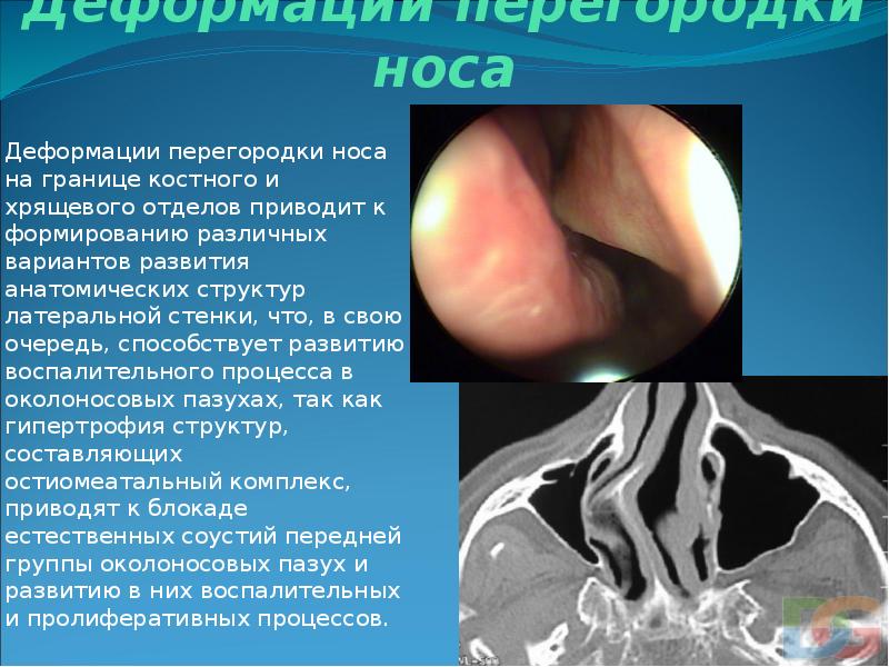 Презентация носа и околоносовых пазух презентация