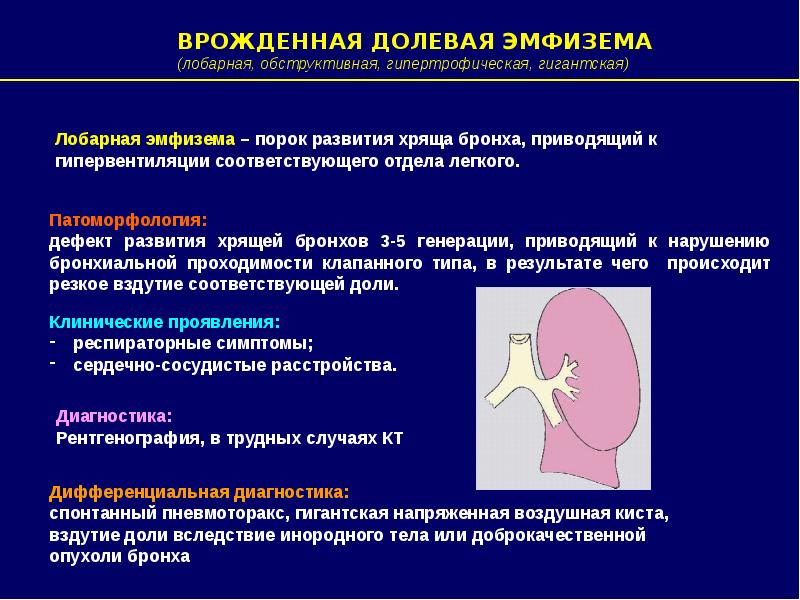 Врожденная лобарная эмфизема клиника рентгенологическая картина принципы лечения