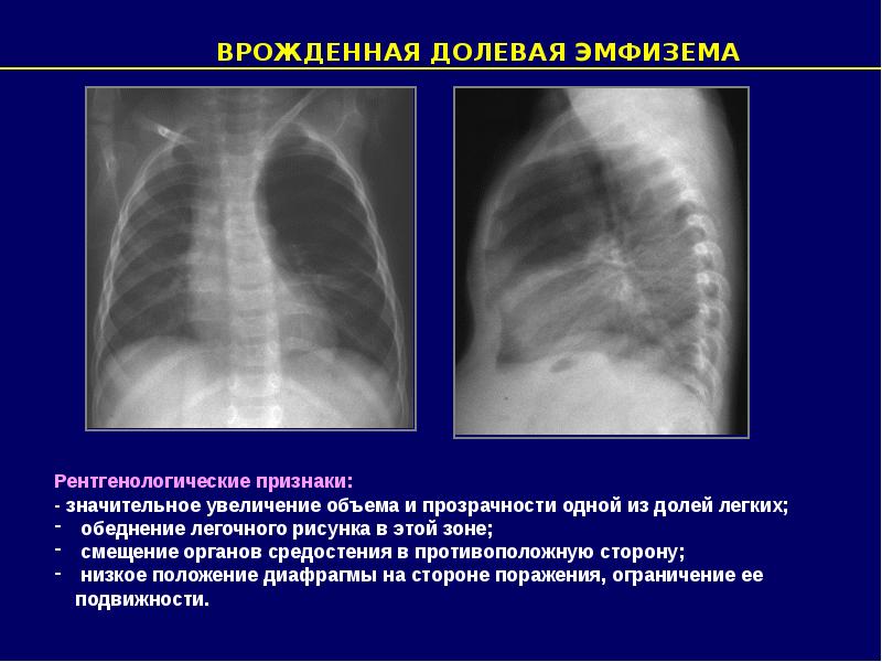 Прямое увеличение изображения достигается