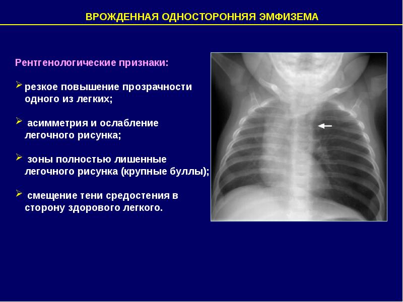 Лучевая диагностика средостения презентация