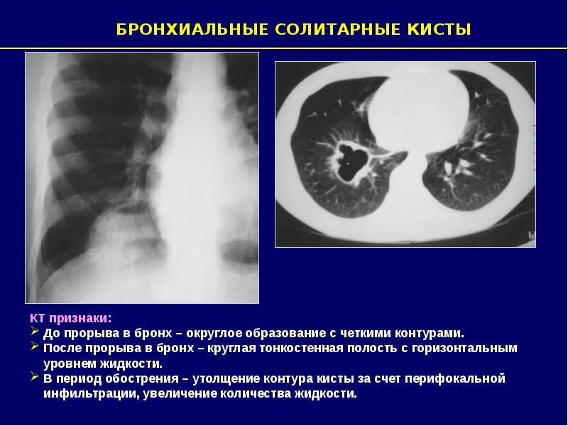 Презентации по лучевой диагностике