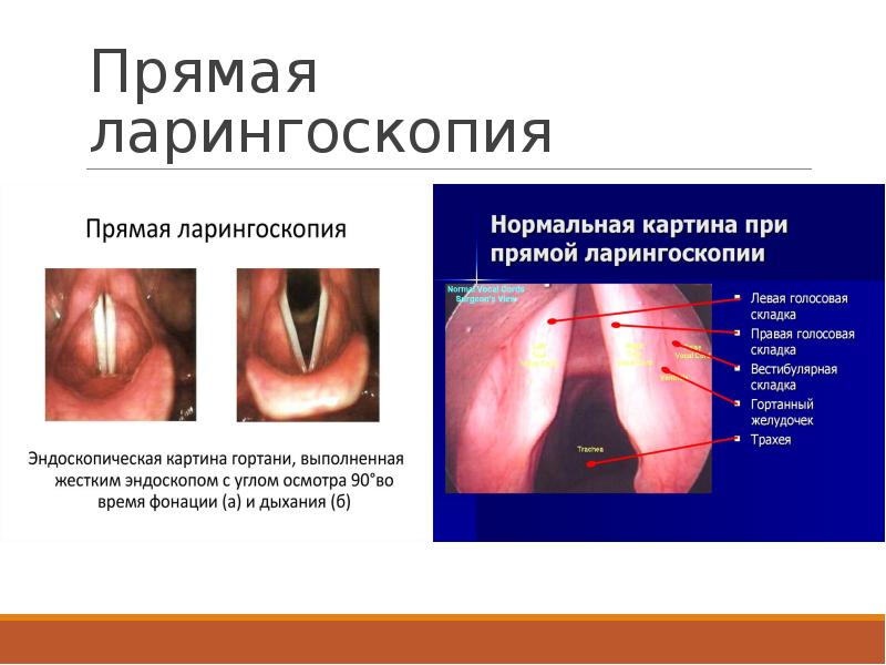 Презентация на тему гортань