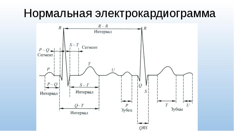 Схема анализа экг