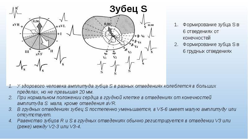 Ось амплитуд. Формирования зубцов в грудных отведениях. Зубец s в грудных отведениях. Формирование зубца р в 6 отведениях. Отведения AVF I при разных осях сердца.