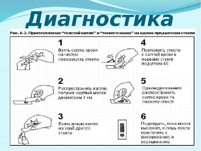 Диагностика