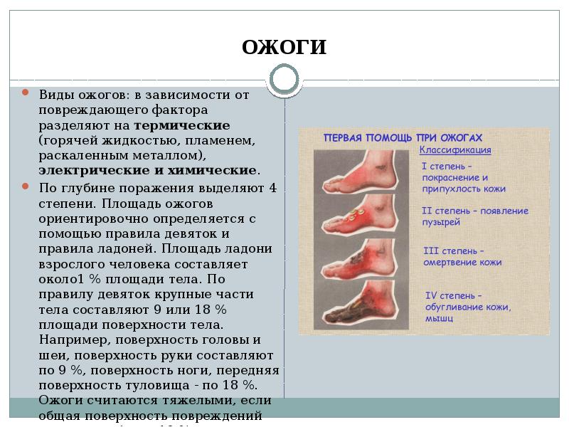 Виды ожогов и первая помощь при ожогах презентация