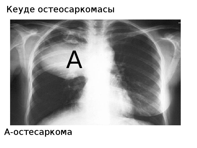 Кеуде жарақаттары презентация