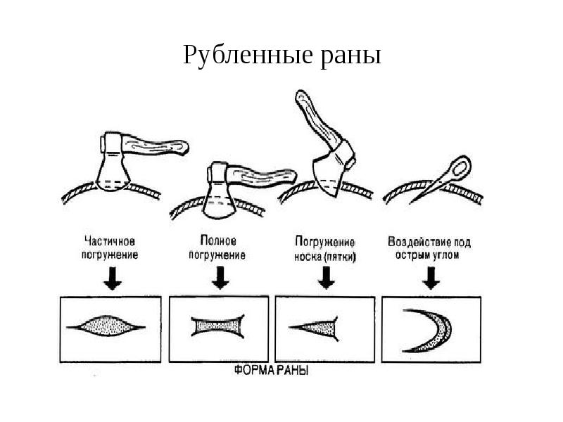 Резаная рана запястья карта вызова смп