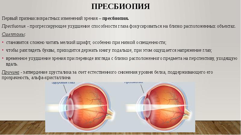 Расплывчатое изображение близкорасположенных предметов