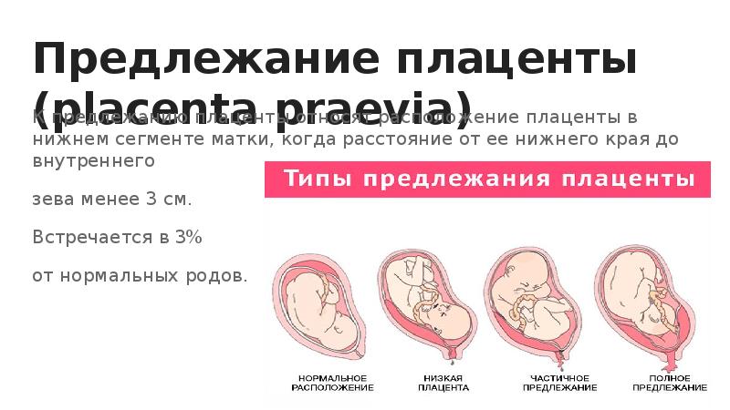 Предлежание это. Краевое предлежание плаценты. Краевое предлежание плаценты при беременности 12 недель. Низкая плацентация краевое предлежание. Низкая краевая плацентация при беременности.