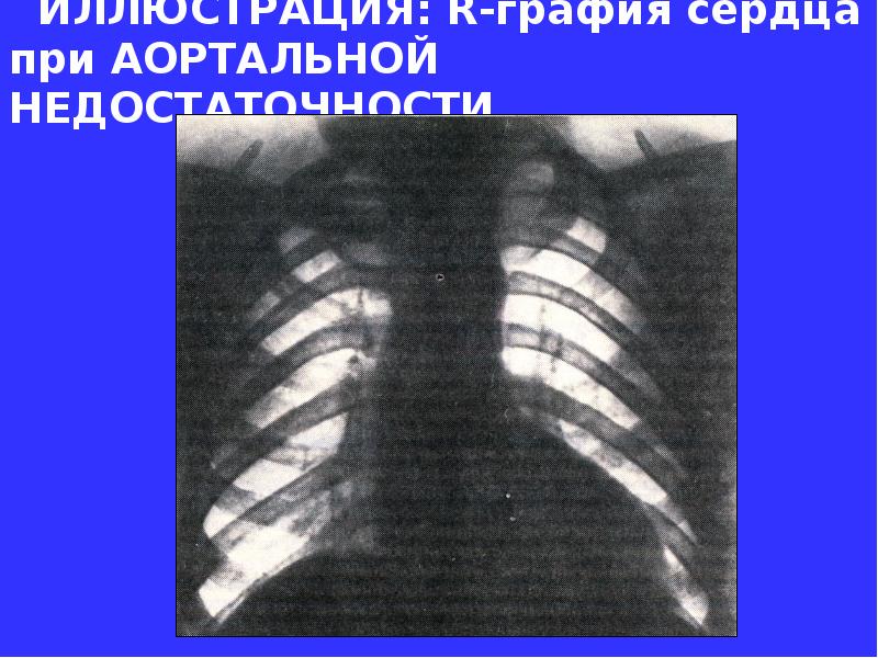 Аритмии презентация факультетская терапия