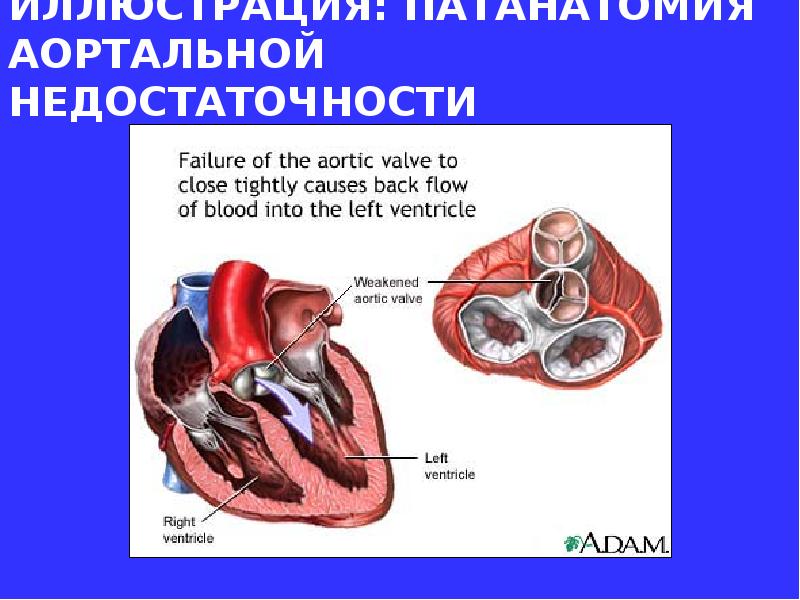 Факультетская терапия