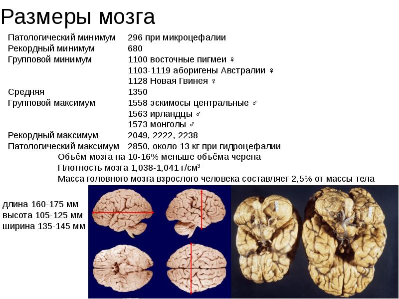 Эволюция размера мозга. Объем мозга. Объем мозга человека. Объем мозга современного. Размер мозга современного человека.