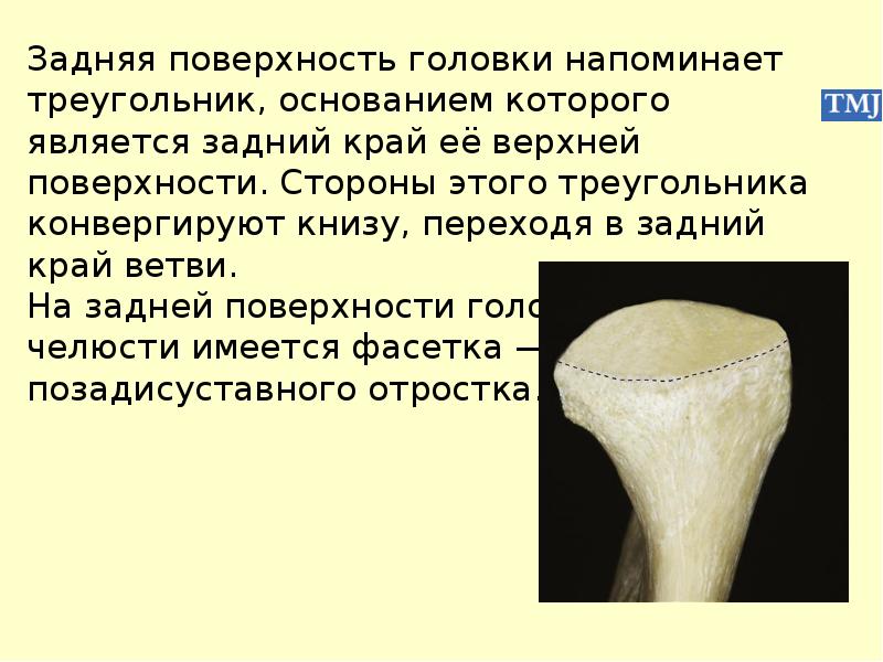Головка состоит из. Головка состоит из