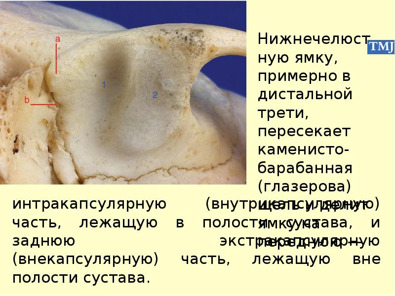 Особенности строения височно нижнечелюстного сустава презентация