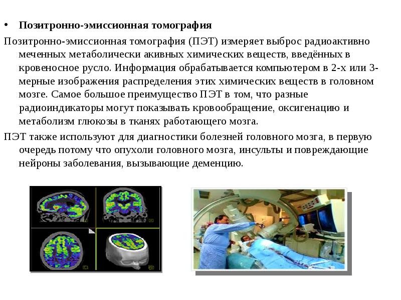 Позитронная эмиссионная томография пэт презентация