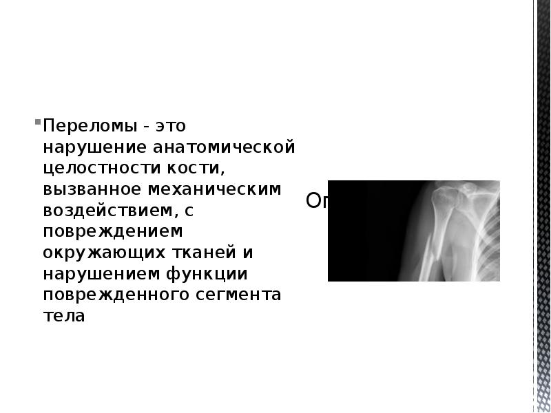 Переломы длинных трубчатых костей презентация