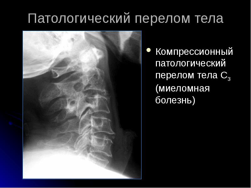 Лучевая диагностика позвоночник презентация