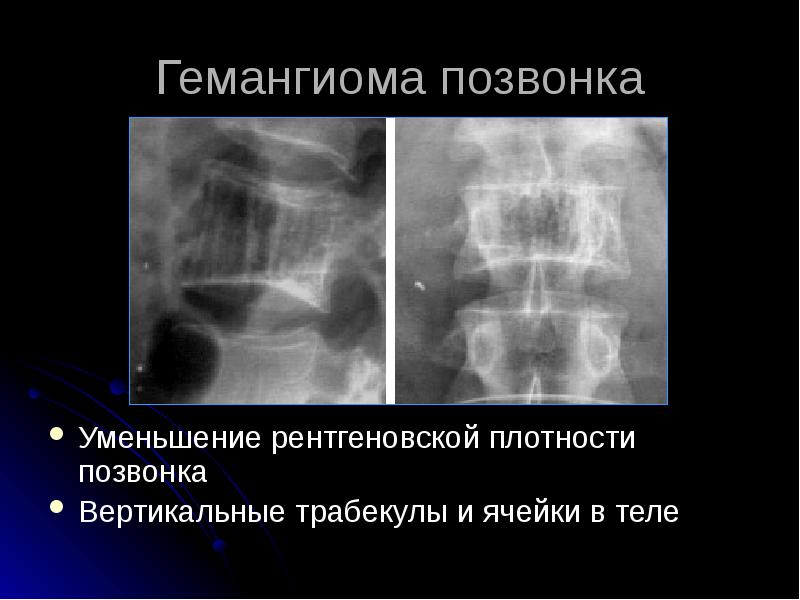 Лучевая диагностика позвоночник презентация