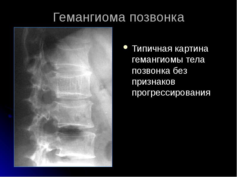 Лучевая диагностика позвоночник презентация