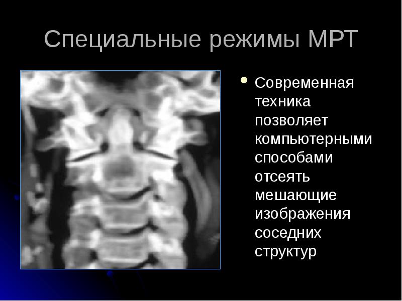 Лучевая диагностика позвоночник презентация