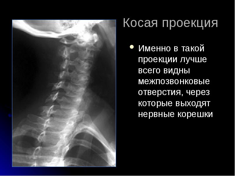 Лучевая диагностика позвоночник презентация