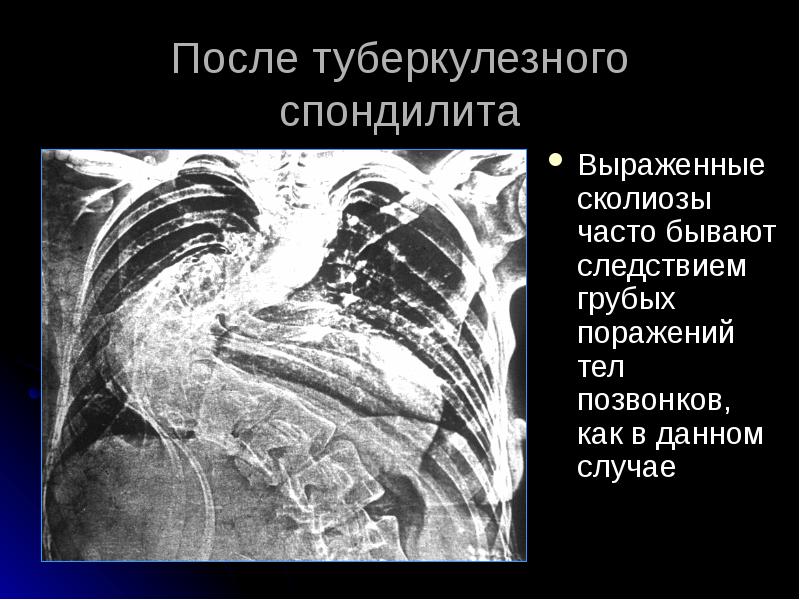 грубый человек. Mma ufc. риск потери плода. грубое поражение. грубое поражение.