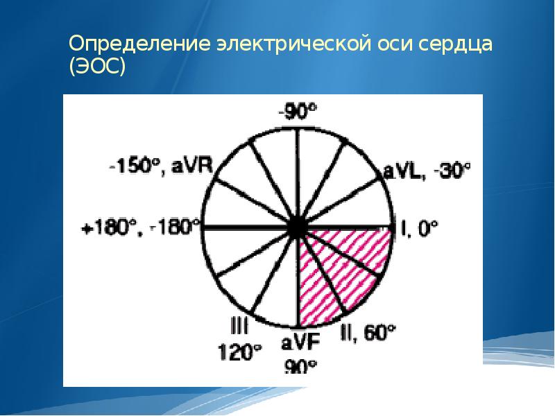 Оси сердца рисунок