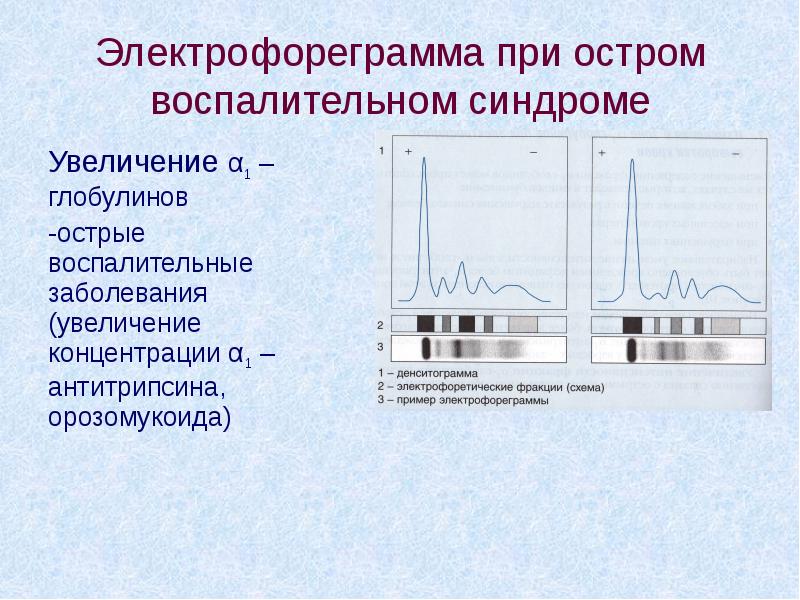 Капиллярный электрофорез презентация