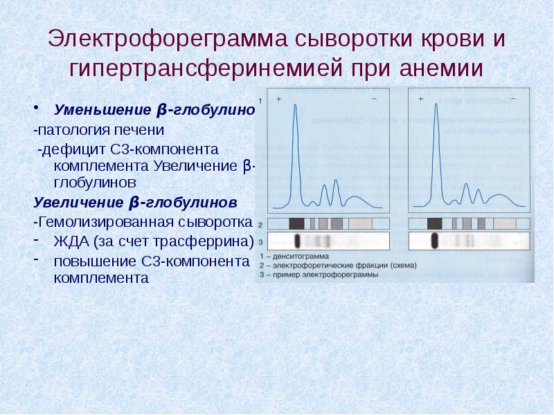 Текст песни электрофорез по разбитым зеркалам. Электрофорез белков сыворотки крови. Электрофореграмма. Электрофореграмма крови. Электрофорез плазмы крови.