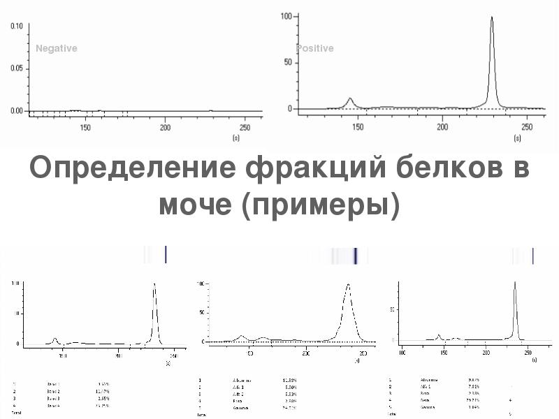 Белковые фракции норма у детей. Фракции α1 и α2-глобулинов. Белковые фракции. Возрастная динамика белковых фракций. Белковые фракции анализ.