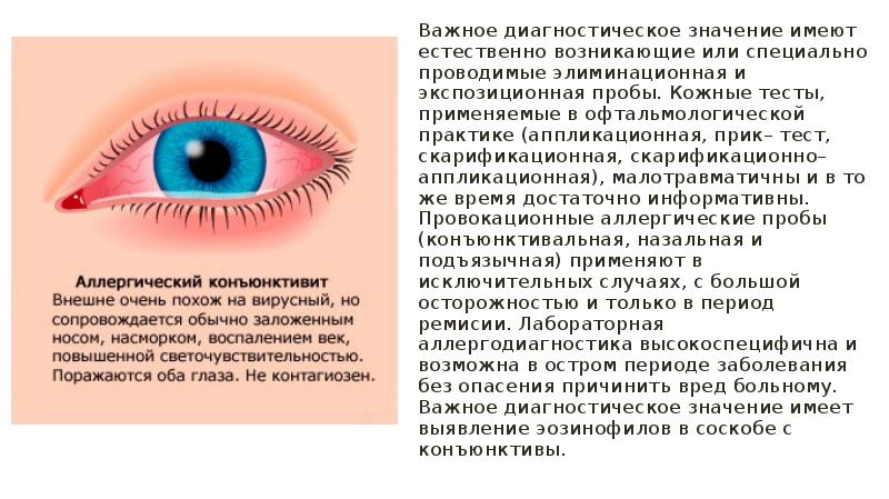 Вирусное заболевание глаз. Конъюнктивит покраснение глаз. Конъюнктивит или покраснение глаз. Острый вирусный конъюнктивит. Вирусный конъюнктивит глаз.