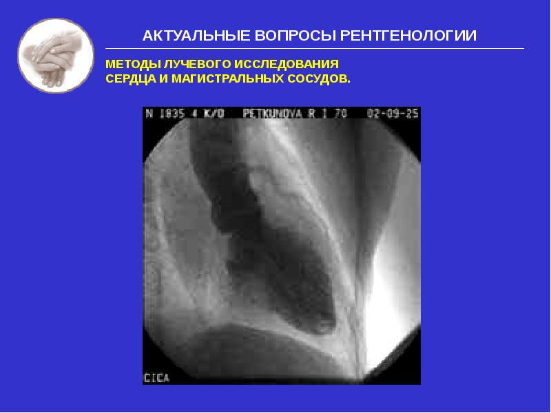 Методы лучевого исследования сердца и сосудов презентация