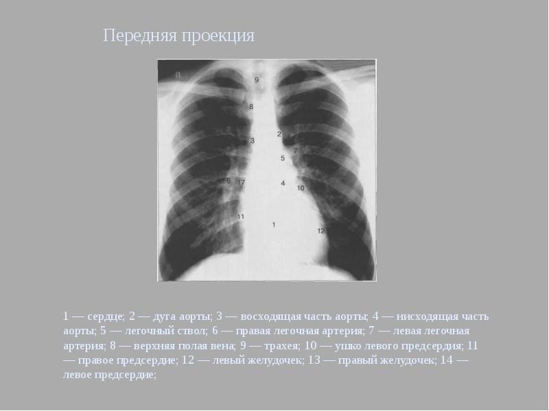 Методы лучевого исследования сердца и сосудов презентация