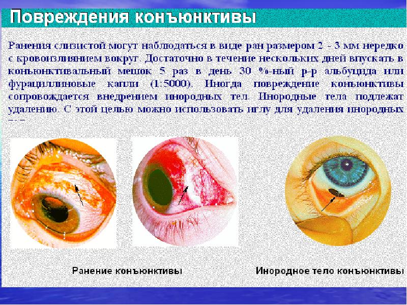 Травмы чло презентация