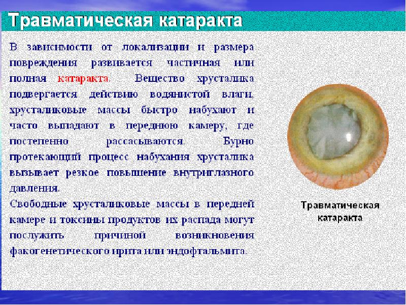 Презентация заболевание и повреждение глаз 8 класс презентация