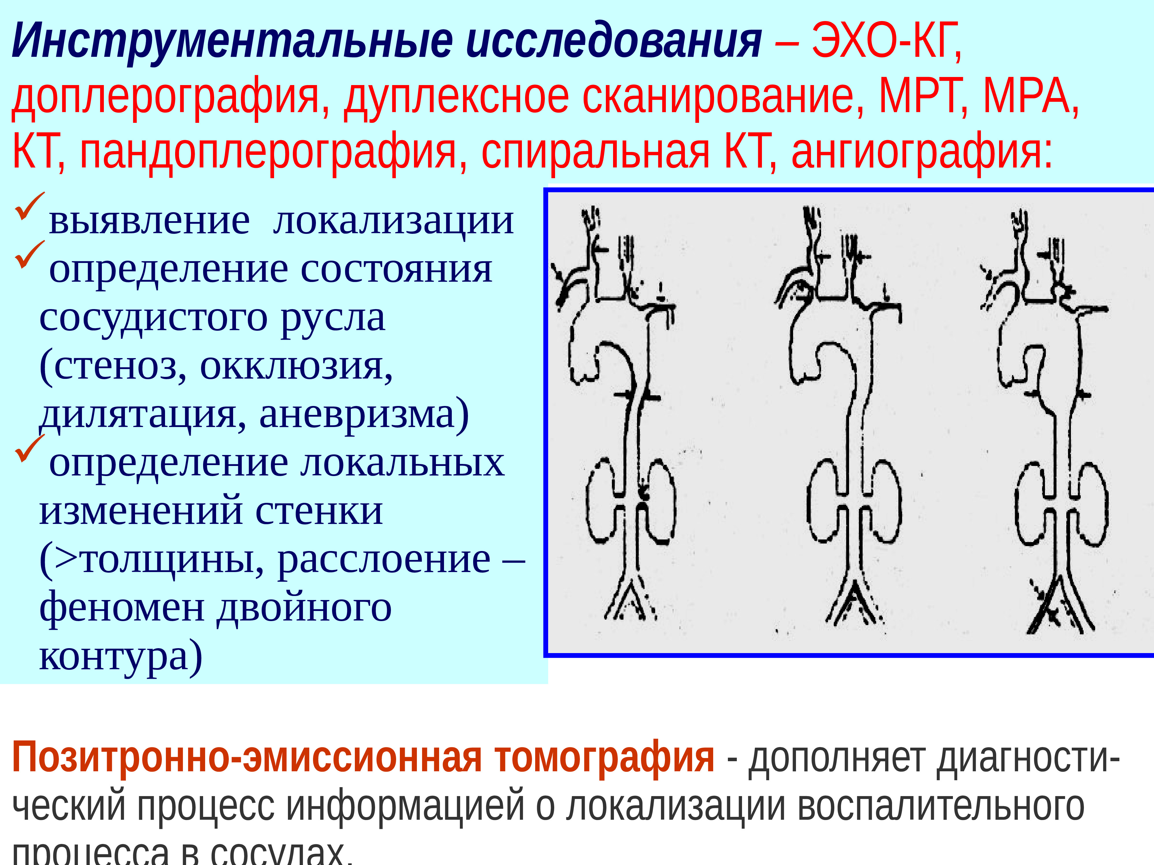 Неспецифический аортоартериит презентация