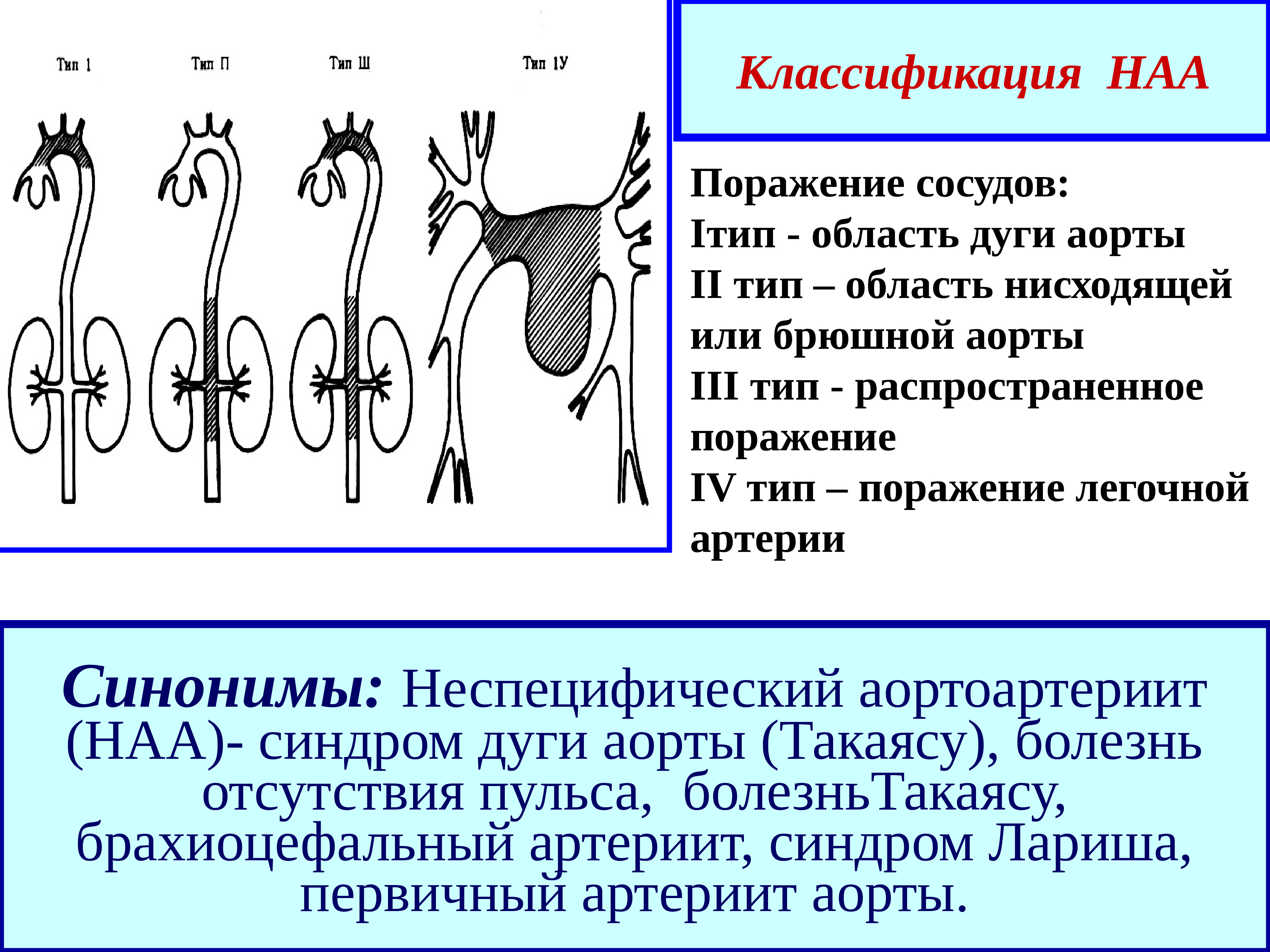 Неспецифический аортоартериит презентация