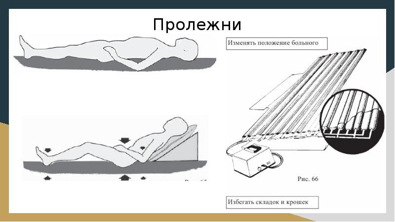 Уход за кожей и естественными складками тяжелобольного пациента презентация